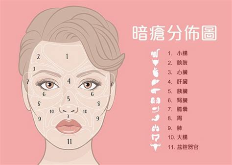 印堂 暗瘡|9大暗瘡位置：下巴暗瘡=腎虧？中醫去暗瘡有用嗎？